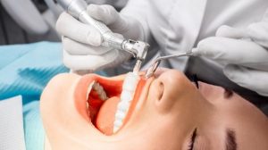 Dental Hygienist Teeth Cleaning From Aspects Dental In Milton Keynes - Scale And Polish Milton Keynes