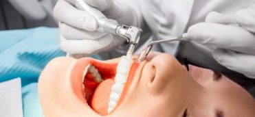 Dental Hygienist Teeth Cleaning From Aspects Dental In Milton Keynes - Scale And Polish Milton Keynes