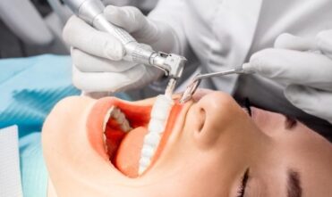 Dental Hygienist Teeth Cleaning From Aspects Dental In Milton Keynes - Scale And Polish Milton Keynes