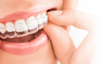 Invisalign Braces From Aspects Dental In Milton Keynes - Invisalign Milton Keynes & Invisalign Lite Milton Keynes