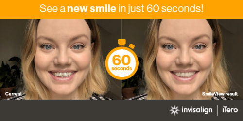 Invisalign Newport Pagnell - Invisalign Results Before And After - Upload A Photo Now