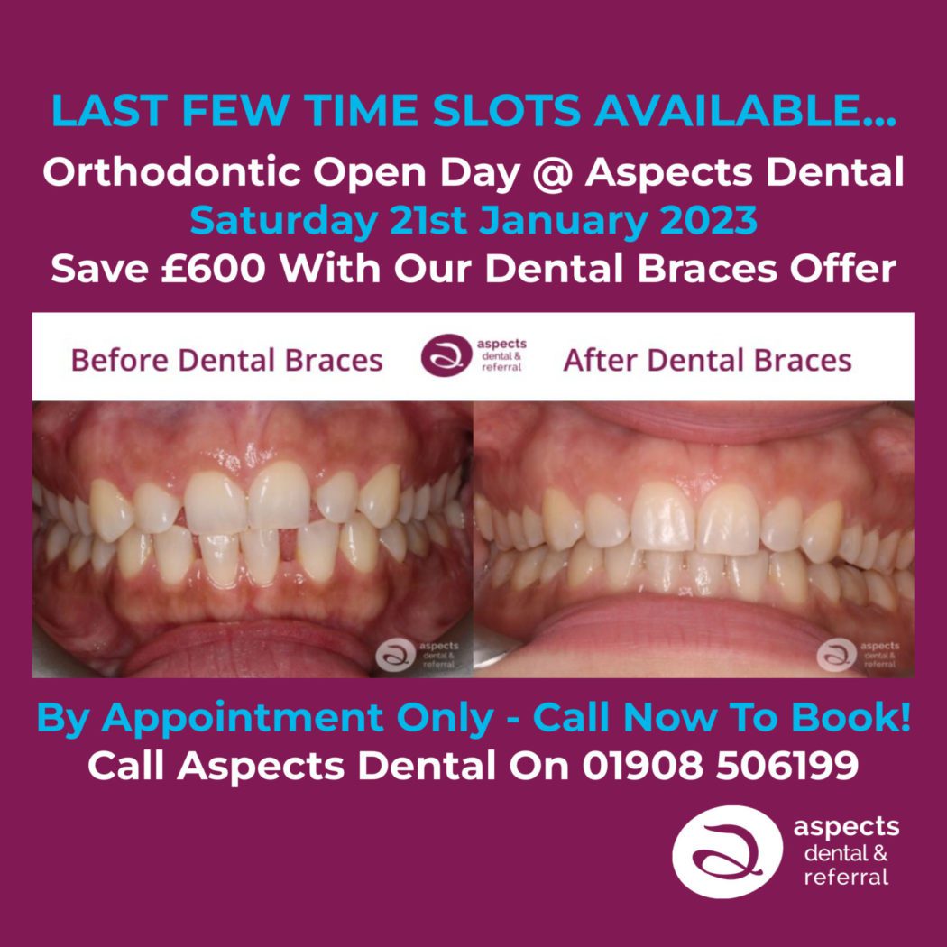 Tooth Extraction And Implant Archives Aspects Dental & Referral