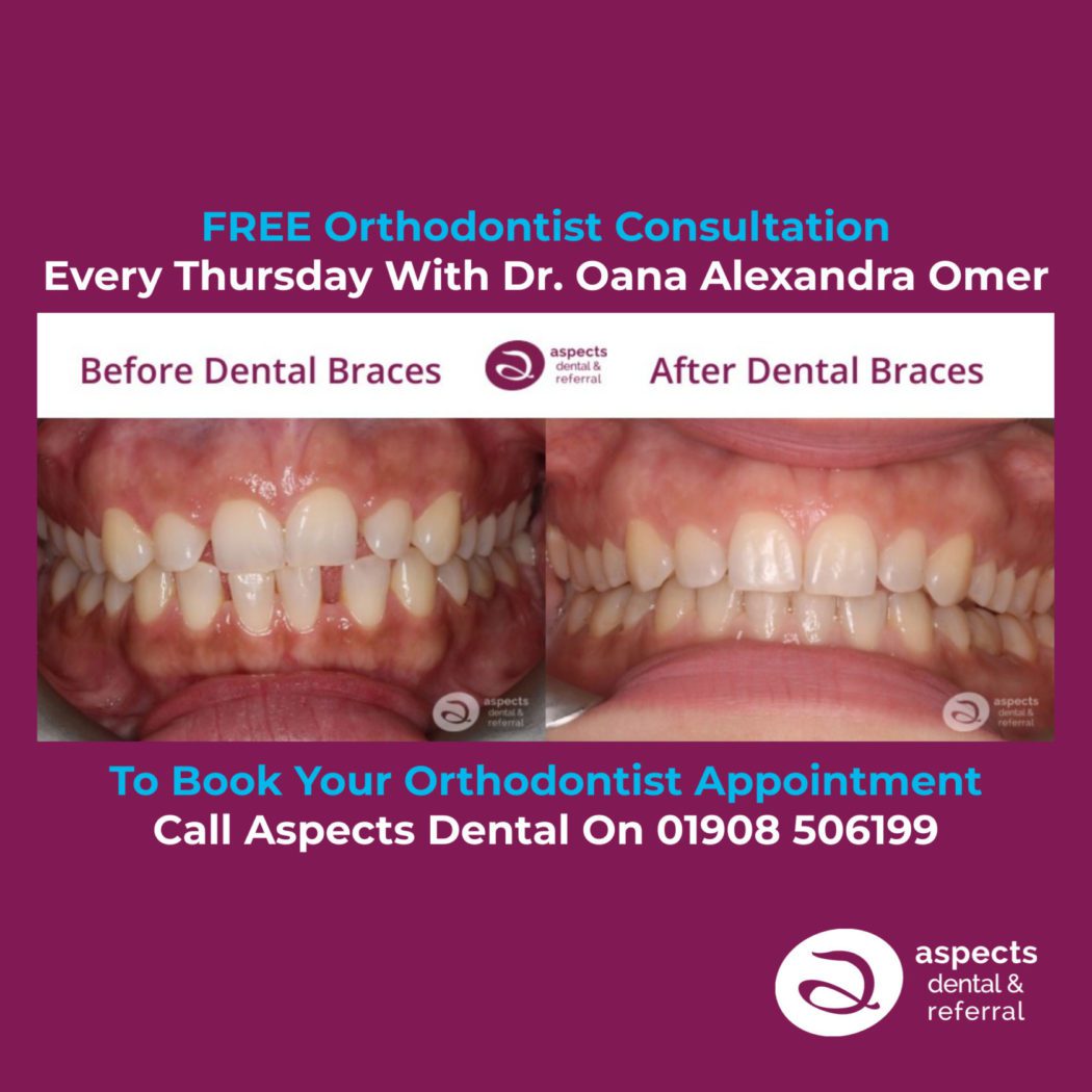 Milton Keynes Orthodontist Offers Free Orthodontist Consultation - Before And After Dental Braces Photos