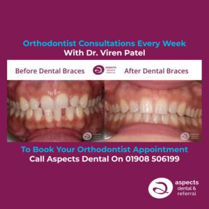 Milton Keynes Orthodontist Offers Orthodontist Consultations Every Week - Private Orthodontist At Aspects Dental