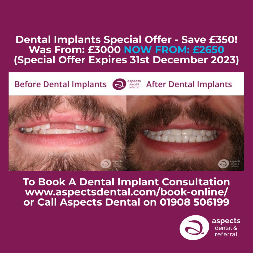 Milton Keynes Implant Dentist Launches Dental Implants Special Offer For Autumn 2023