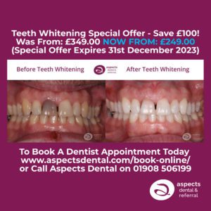 Milton Keynes Teeth Whitening Dentist Launches Teeth Whitening Special Offer For Autumn 2023