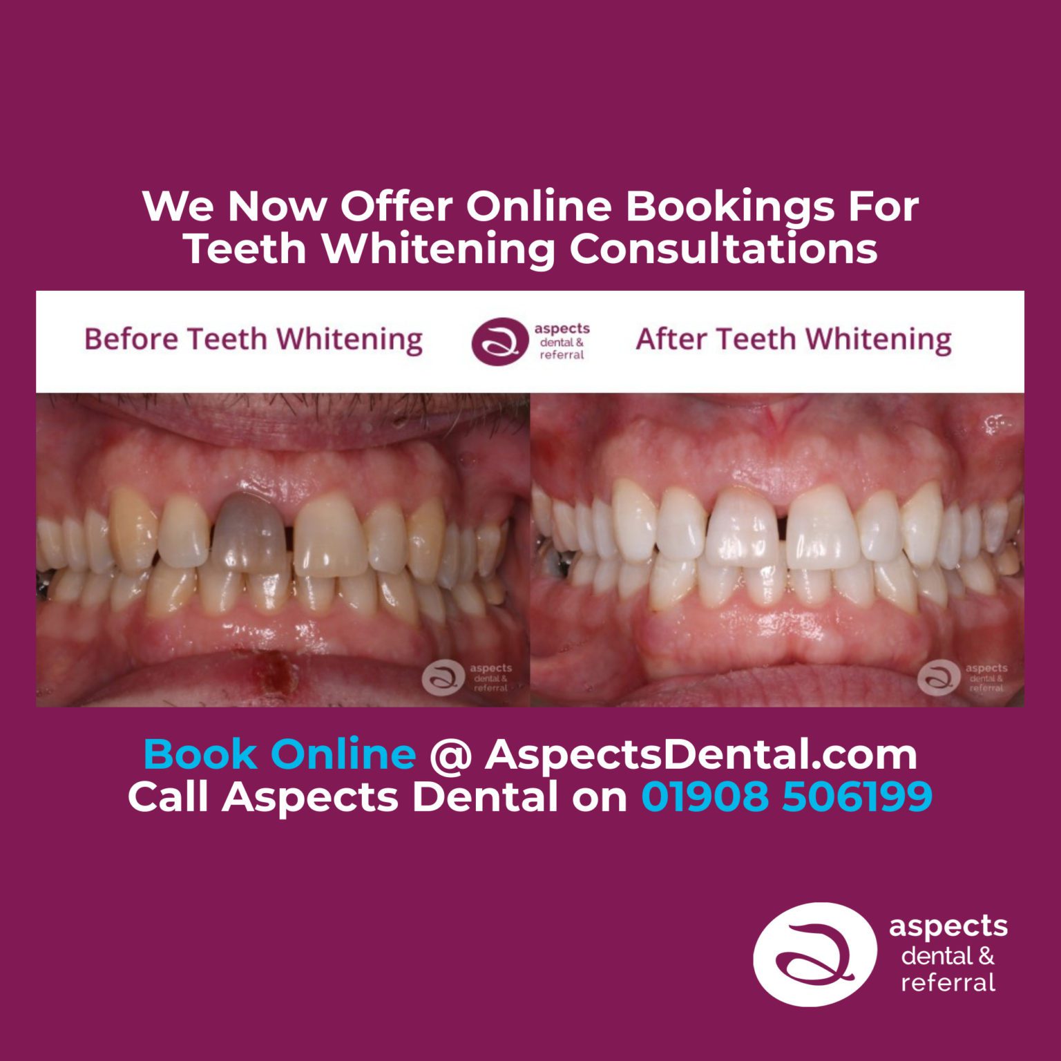 Milton Keynes Dentist Now Offers Online Bookings For Teeth Whitening
