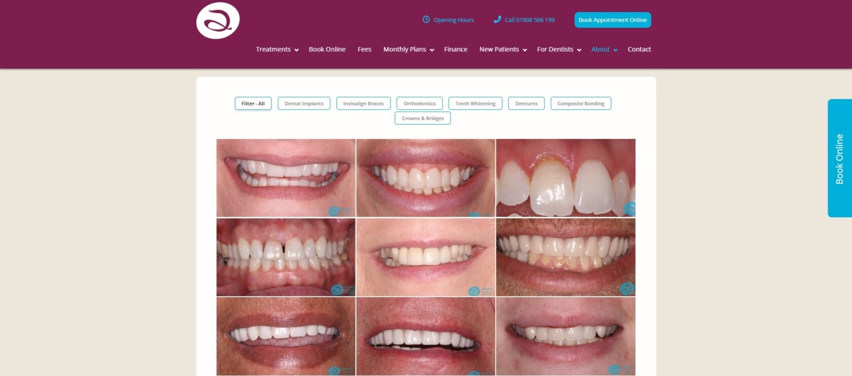 Milton Keynes Dentist Launches New Cosmetic Dentist Before And After Gallery