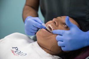 Aspects Dental - Clear Dental Braces Milton Keynes - Orthodontist Milton Keynes