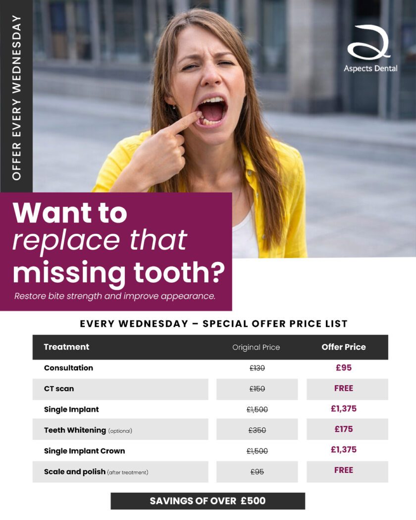Milton Keynes Implant Dentist Offers Time Limited Missing Tooth Replacement Special Offer