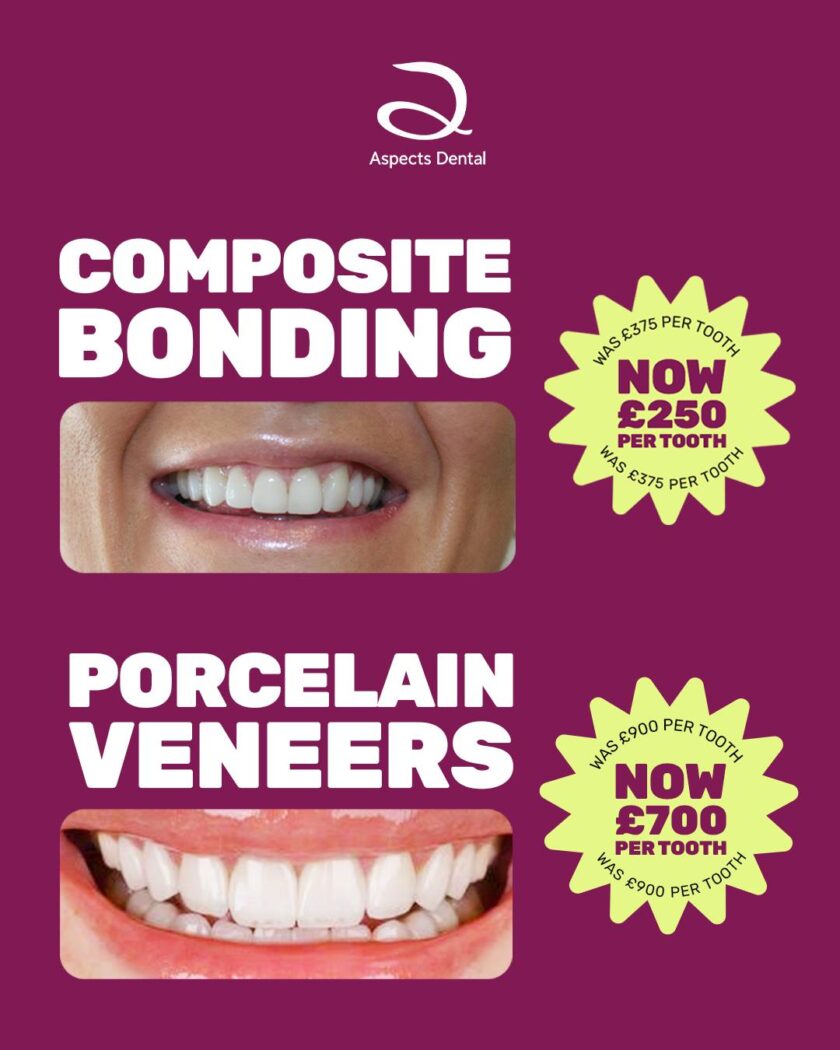 Milton Keynes Cosmetic Dentist Launches Composite Bonding Special Offer & Dental Veneers Special Offer